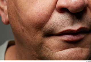 HD Face Skin Umberto Espinar cheek lips mouth nose skin…